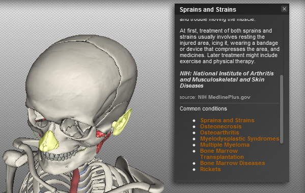 BioDigital Human conditions